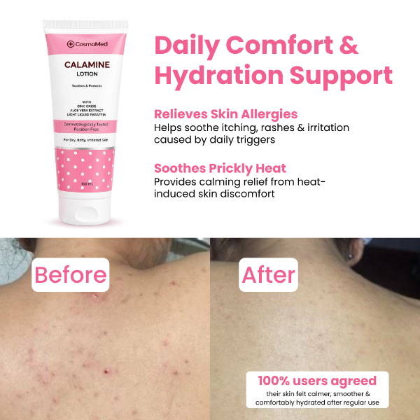 Daily Confort & Hydration Support